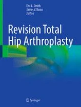 Revision Total Hip Arthroplasty image