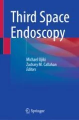 Third Space Endoscopy image