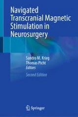 Navigated Transcranial Magnetic Stimulation in Neurosurgery image