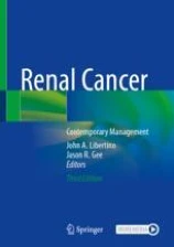 Renal Cancer image