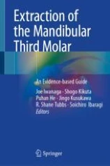 Extraction of the Mandibular Third Molar圖片