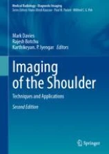 Imaging of the Shoulder圖片