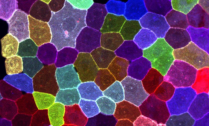 Multicolor live-cell imaging identifies asynthetic fission