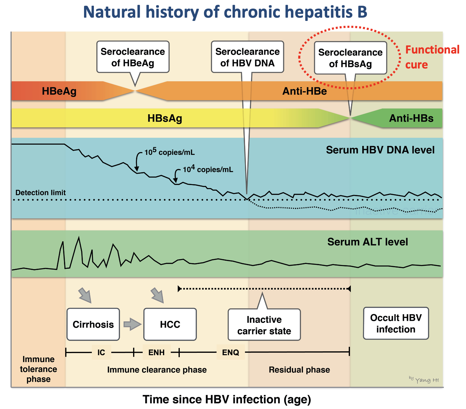 PD‐1 levels can predict spontaneous functional cure in inactive chronic hepatitis B carriers