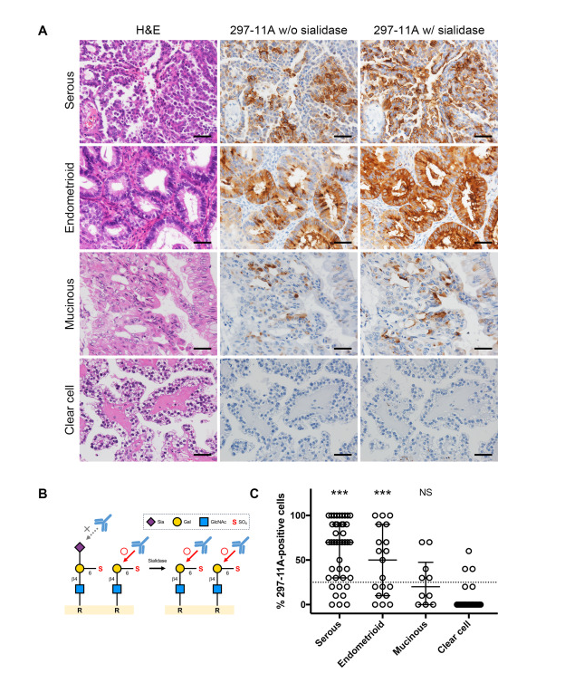 Structural elucidation and prognostic relevance of 297-11A-sulfated glycans in ovarian carcinoma