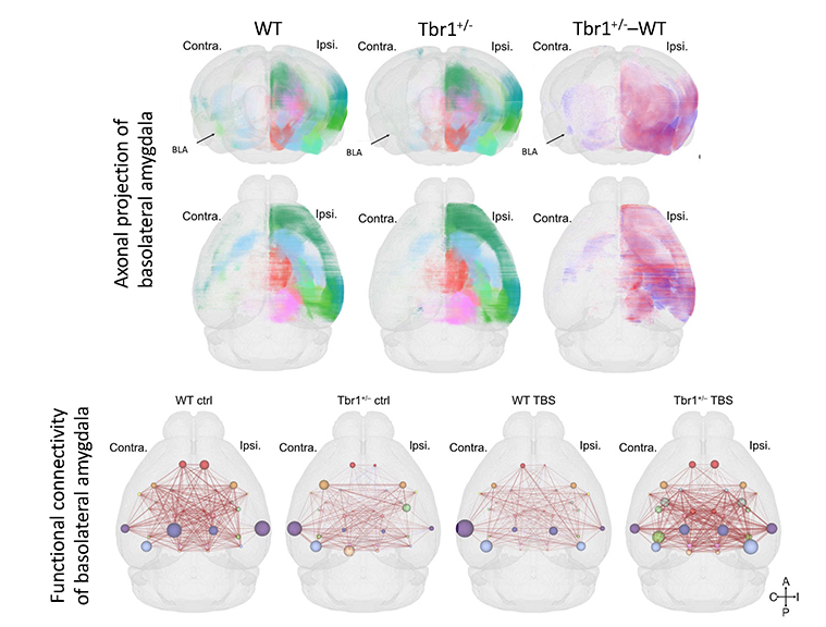 Deep brain stimulation of the Tbr1-deficient mouse model of autism spectrum disorder at the basolateral amygdala alters amygdalar connectivity, whole-brain synchronization, and social behaviors