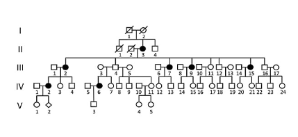 Role of IL3RA in a Family with Lumbar Spinal Stenosis