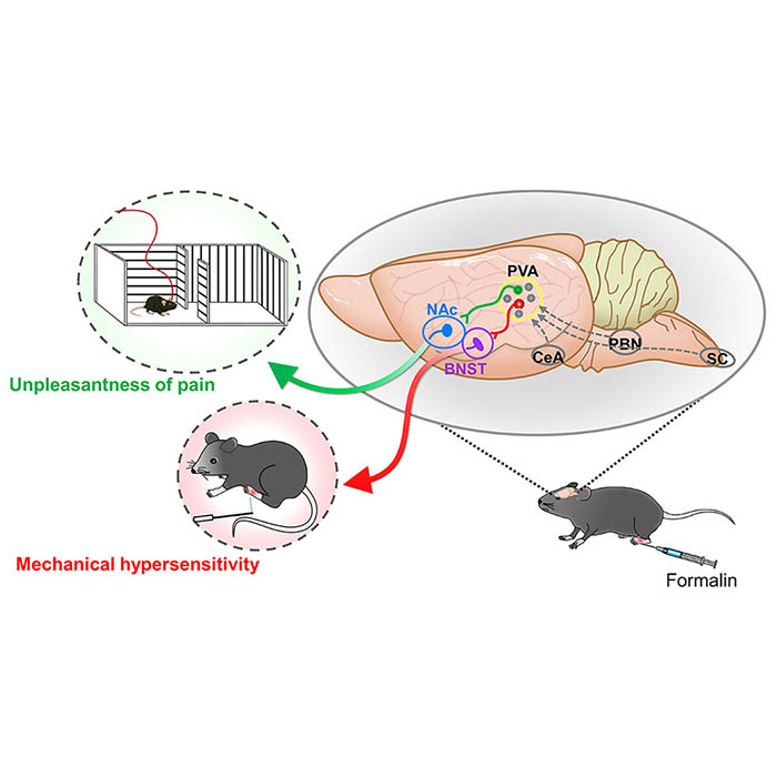 Separate anterior paraventricular thalamus projections differentially regulate sensory and affective aspects of pain