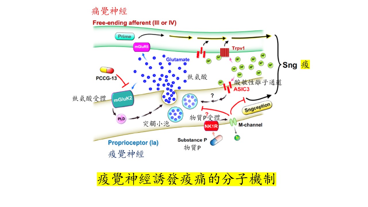 Finding sngceptors – a novel sngception theory to shape new era of sng-pain precision medicine