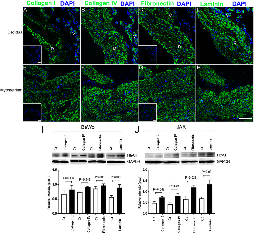Extracellular matrix induces trophoblast HtrA4 expression: Implications for the pathogenesis of placenta accreta spectrum