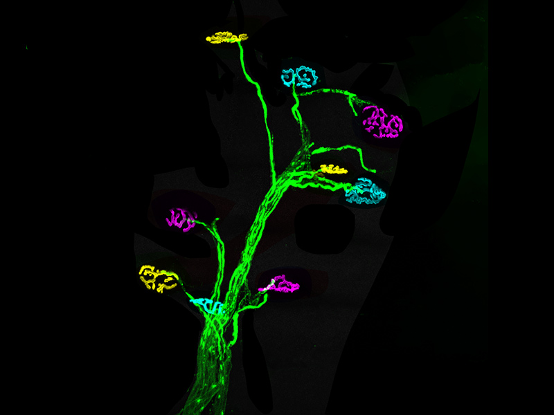 MiR-34 at the crossroads of SMA pathogenesis and therapy: Emerging biomarker and therapeutic target