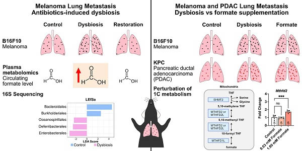 Gut microbiota-derived formate exacerbates pulmonary metastasis in cancer