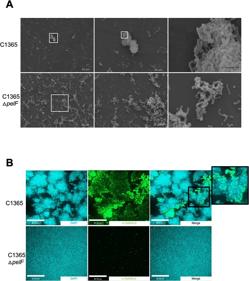 Epoxide Stereochemistry Controls Regioselective Ketoreduction in Epoxyquinoid Biosynthesis