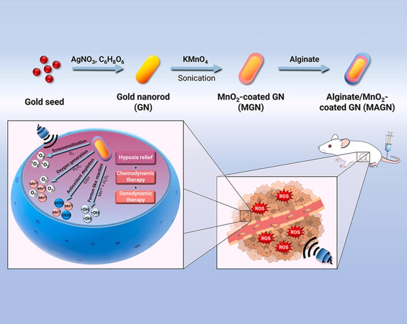 Tumour microenvironment-modulating alginate/manganese dioxide-coated gold nanorods for synergistic chemodynamic and sonodynamic therapy