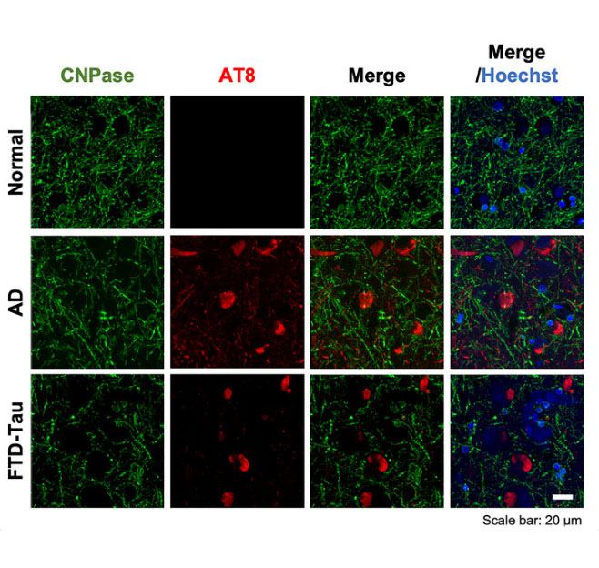 ENT1 inhibition links oligodendrocyte lipid metabolism to connectivity in tauopathy